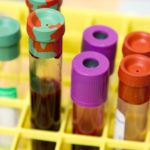 How often should you do a blood test?