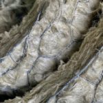 What are Asbestos related diseases?