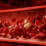 Iron deficiency anemia – how does it occur?
