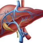 10 Facts about Cirrhosis - Interesting and Useful Facts