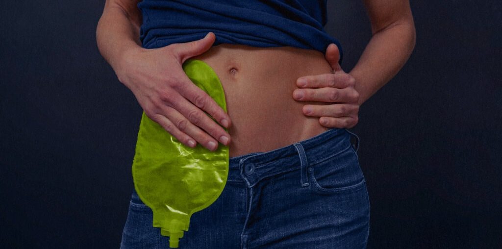 10 Facts about Crohn's Disease - Interesting and Useful Facts